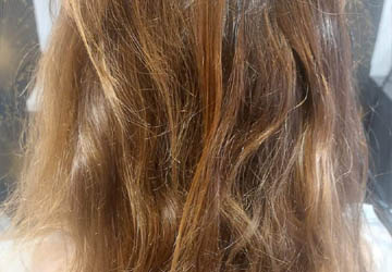 Trychologia Zielona Góra